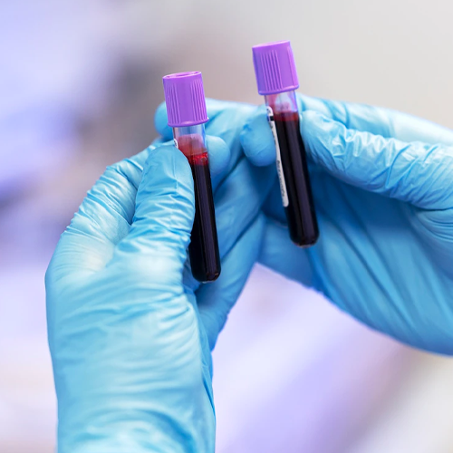 Control Glucemia y Colesterol Alicante | F Cabrera Torres